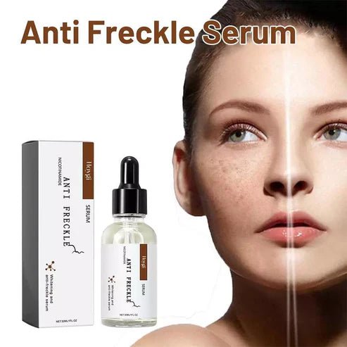 Luxury in a Bottle: Serum That Targets Freckles & Enhances Radiance - Urban Mart